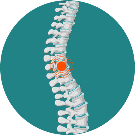 Lesiones de espalda - Ulrike Göpel - Traumatologia en Tenerife Norte y Sur