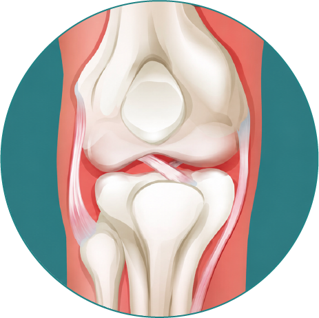 terapia_regenerativa_cartilago